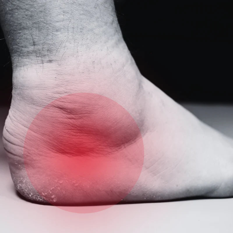 FootGuard™ – Avancerat Fotstöd för Skydd, Smärtlindring & Komfort