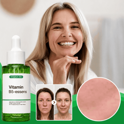 SkinRelief™ – Serum för Lugnare och Mindre Röd Hud
