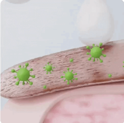 NailRelief™ – Spray mot Nagelsvamp för Friskare & Starkare Naglar