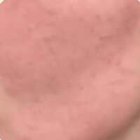 SkinRelief™ – Serum för Lugnare och Mindre Röd Hud