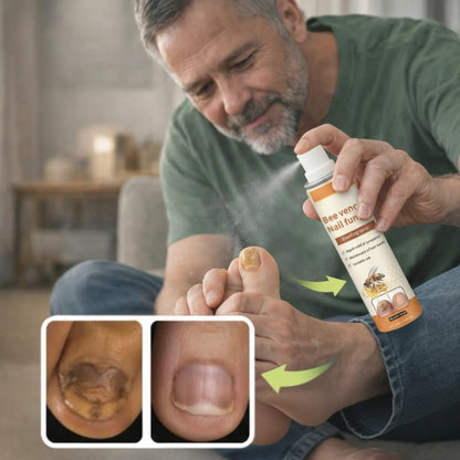 NailRelief™ – Spray mot Nagelsvamp för Friskare & Starkare Naglar