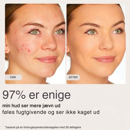 SkinPerfect™ – Utjämnande kräm för jämn hud och mindre synliga porer