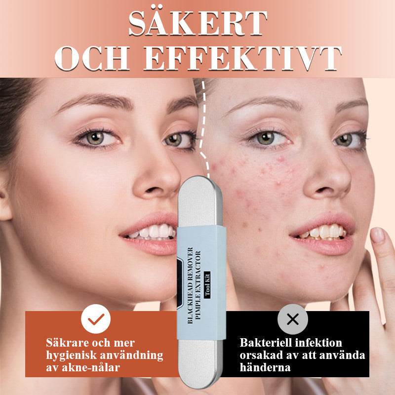 Veluna™ PoreCare Kit – Professionell Portömning Hemma