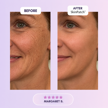 SkinPatch™ – Silikonplåster för Rynkor & Ärr