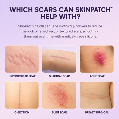 SkinPatch™ – Silikonplåster för Rynkor & Ärr