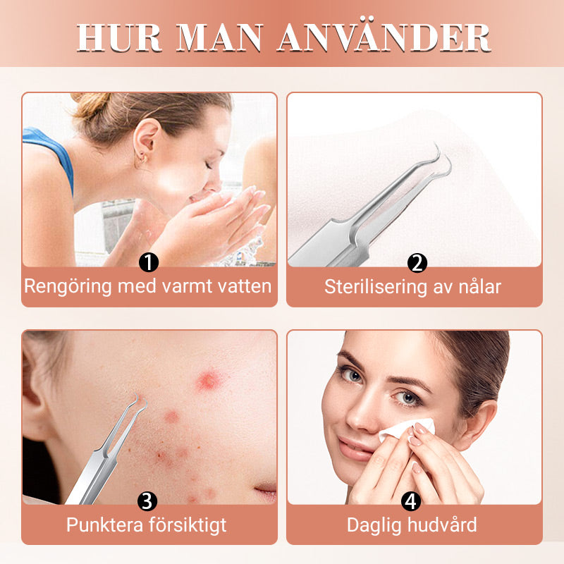 Veluna™ PoreCare Kit – Professionell Portömning Hemma