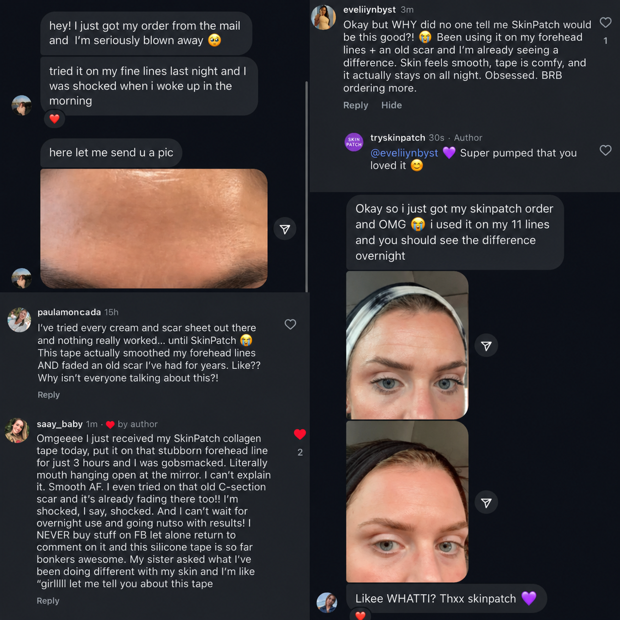 SkinPatch™ – Silikonplåster för Rynkor & Ärr