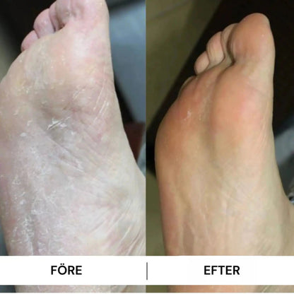 HeelFix™ – Reparerande Fotstick för Spruckna Hälar & Silkeslena Fötter