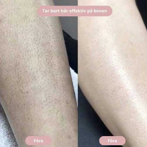 Skinova™ – Intimtrimmer för Silkeslen Rakning utan Irritation