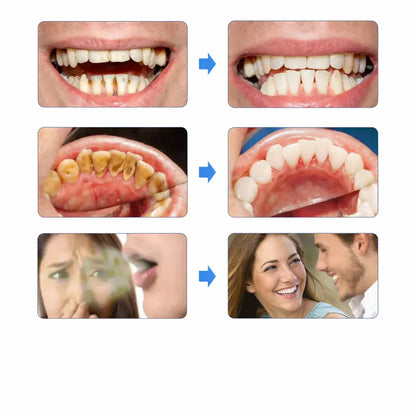 Dentify™ – Elektrisk Tandstensborttagare för Renare & Friskare Tänder Hemma