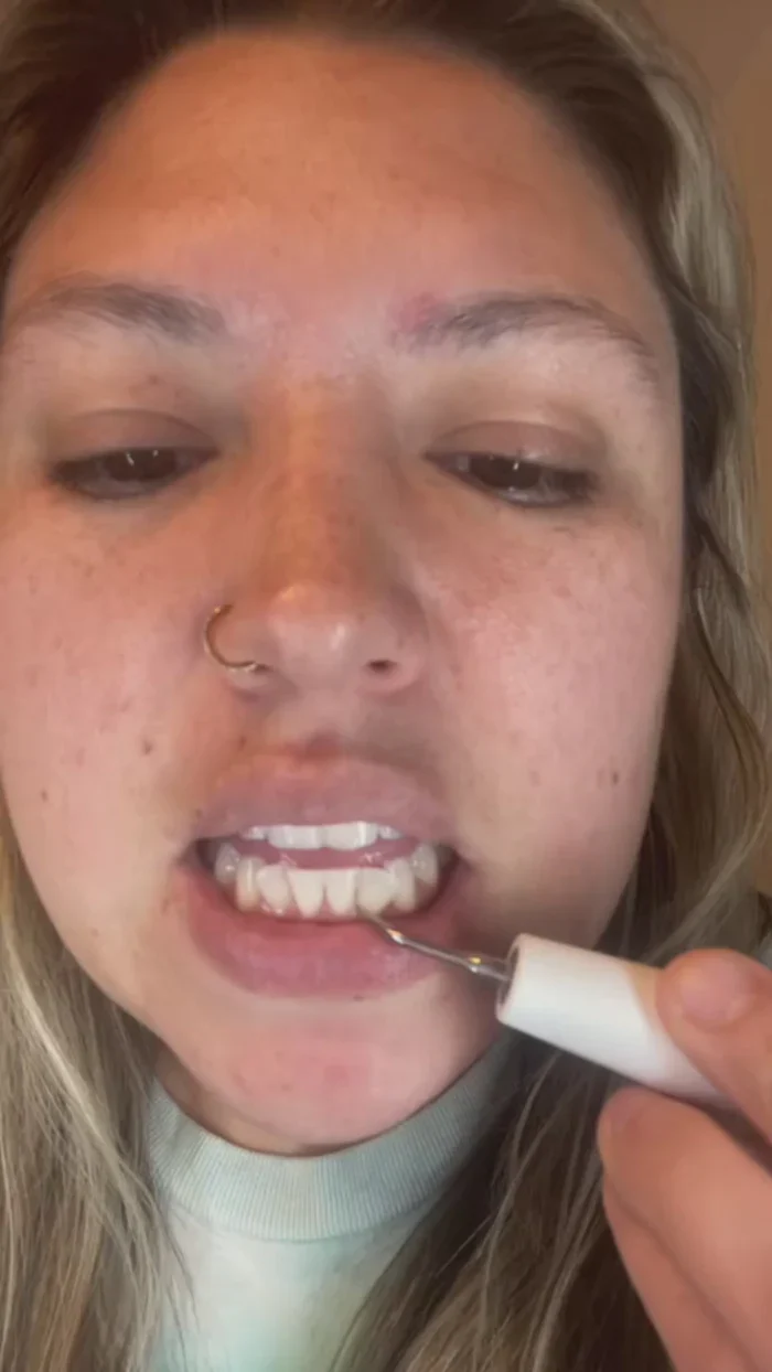 Dentify™ – Elektrisk Tandstensborttagare för Renare & Friskare Tänder Hemma