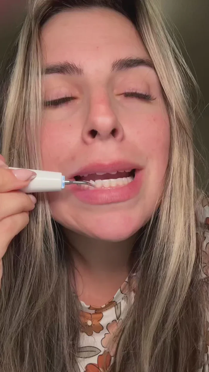 Dentify™ – Elektrisk Tandstensborttagare för Renare & Friskare Tänder Hemma